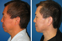 Before & After Photos